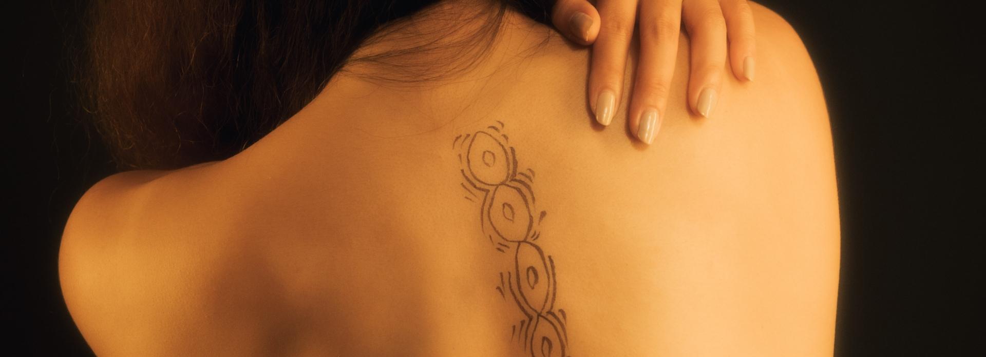 Discectomy Drawbacks